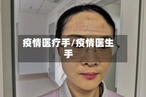 疫情医疗手/疫情医生手
