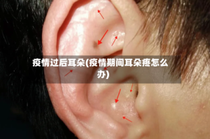 疫情过后耳朵(疫情期间耳朵疼怎么办)
