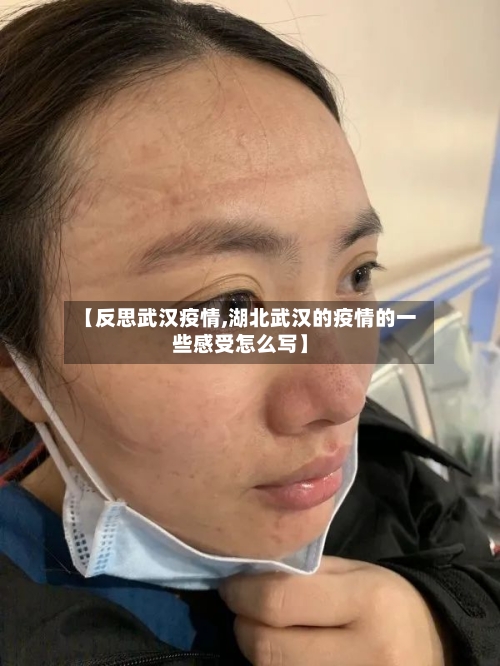 【反思武汉疫情,湖北武汉的疫情的一些感受怎么写】-第2张图片