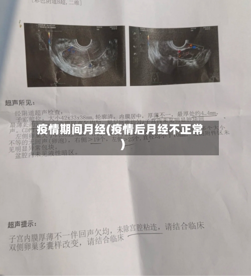 疫情期间月经(疫情后月经不正常)-第1张图片